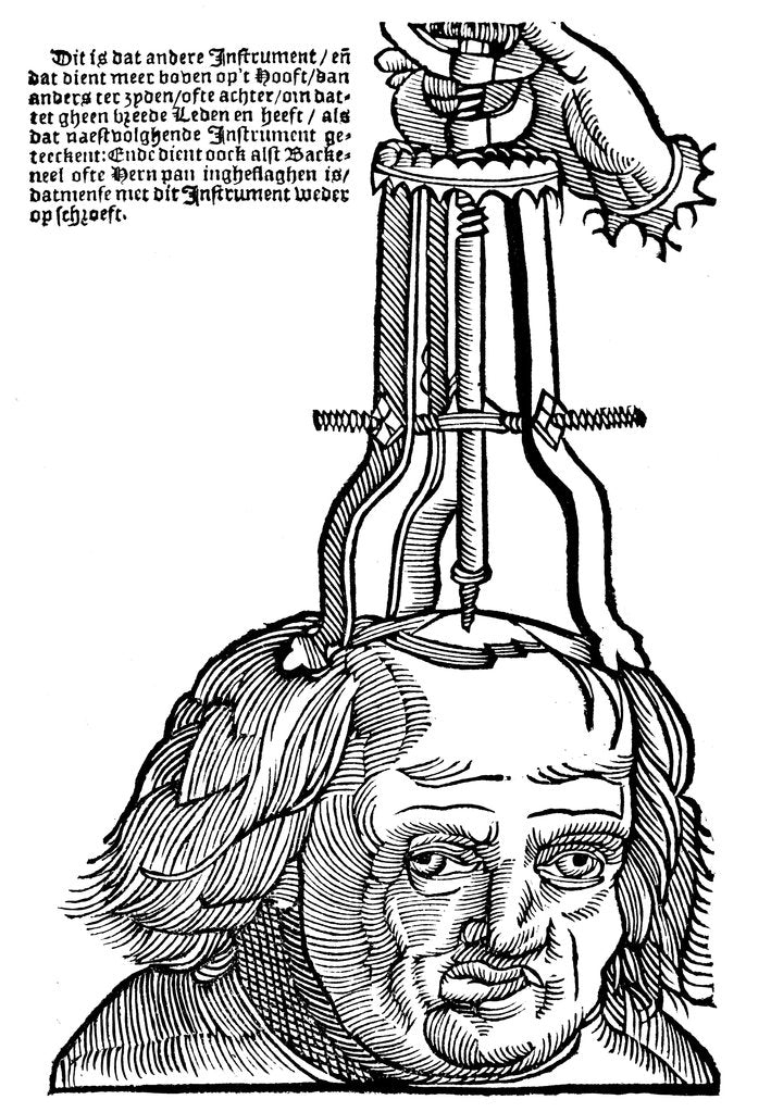 Detail of Trephination, 1593 by Unknown