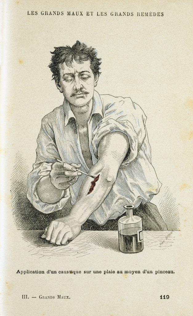 Detail of Painting a wound with an antiseptic solution, c1890 by Unknown