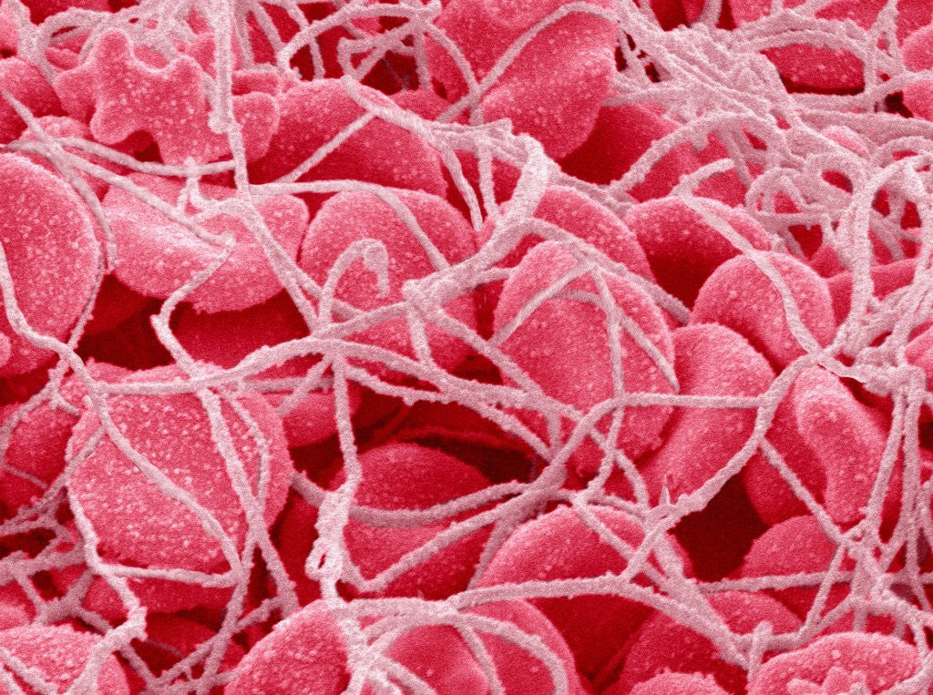 Detail of Coagulated Red Blood Cells by Corbis