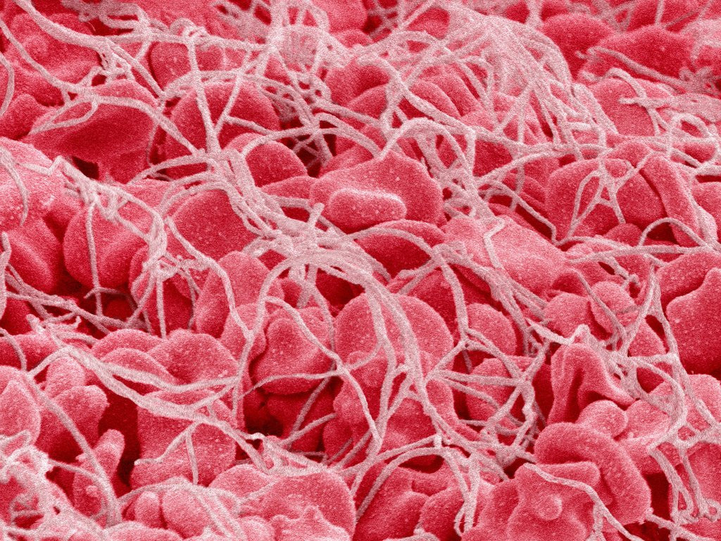 Detail of Coagulated Human Red Blood Cells by Corbis