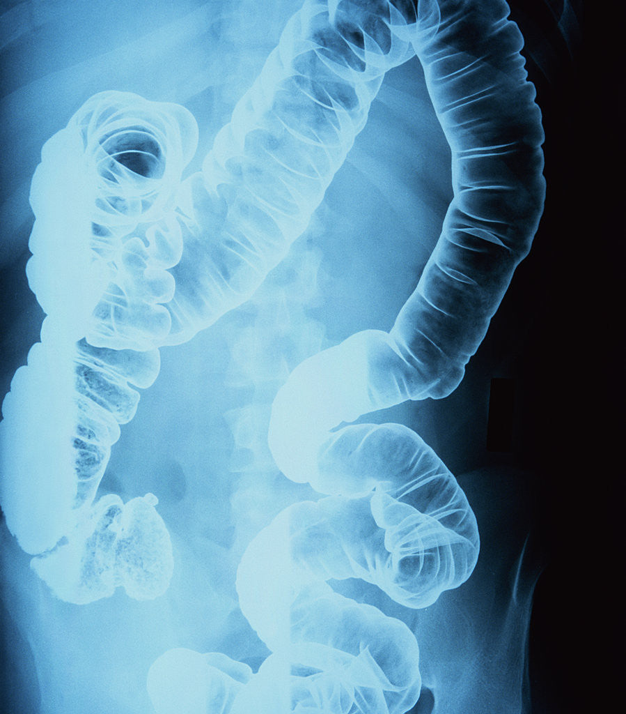 Detail of X-Ray of Intestines by Corbis