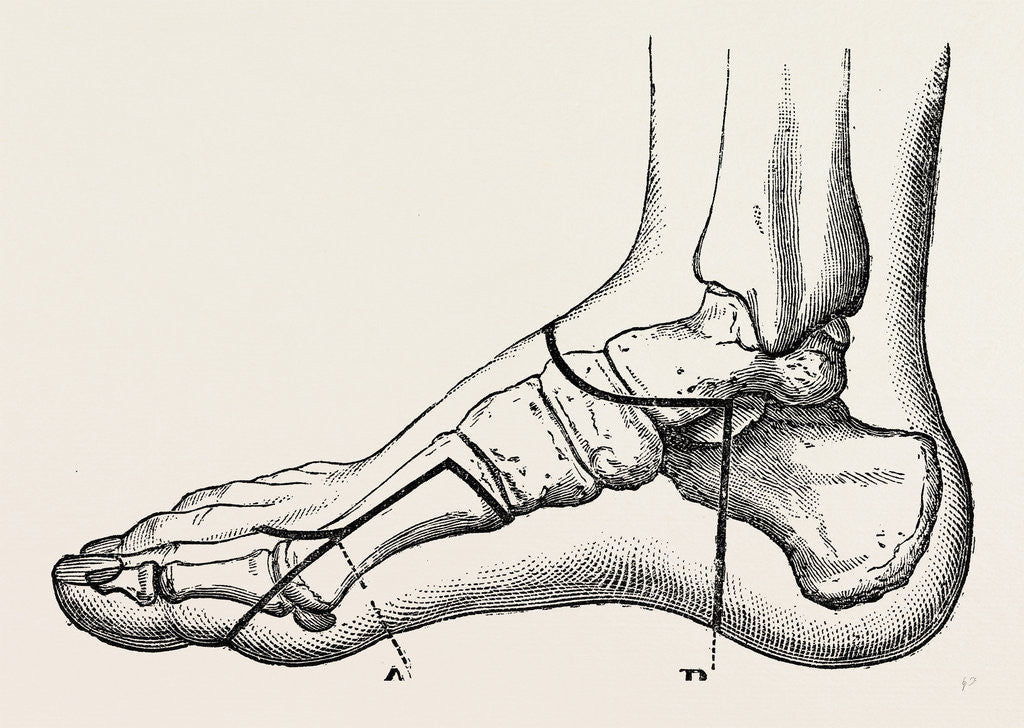 Detail of Disarticulation of the great toe by Anonymous