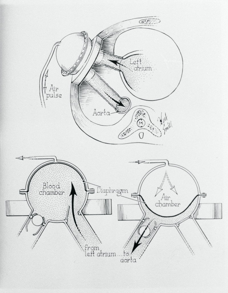 Detail of Diagram of Artificial Heart Compression by Corbis